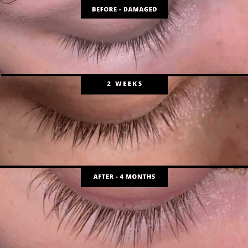 Lash Growth Serum Reviews - Youthphoria Australia