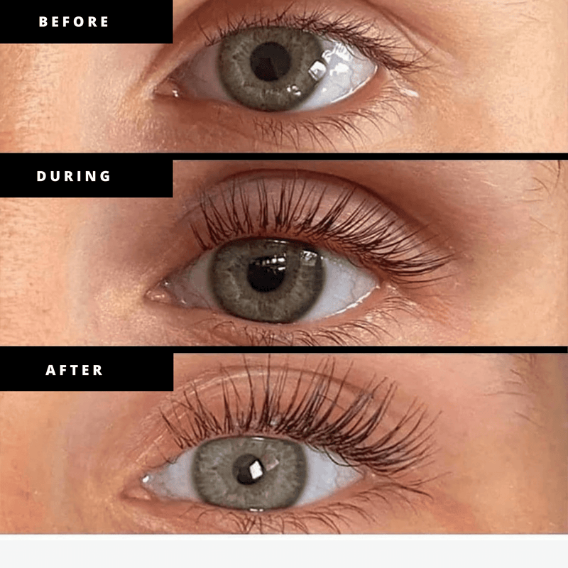 Strong Lash Growth Serum Results - Youthphoria Australia